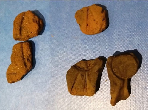 Fragments of Moulds, including a ring mould (bottom right)